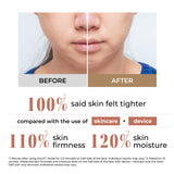 Photo PLUS Deep Lift