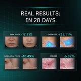Blue Green Lift Mask Pro